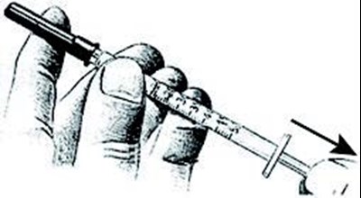 Lueprolide Injection (Figure E)