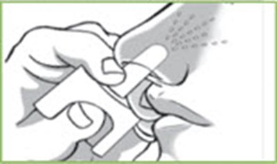 Figure (Valtoco 14)
