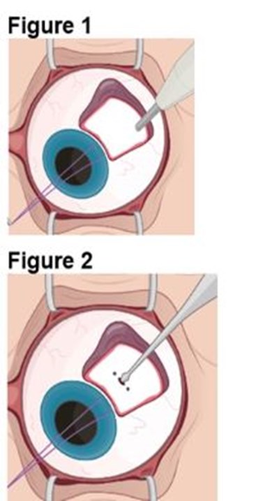 Figures 1 And 2 (Encelto Figure 1)