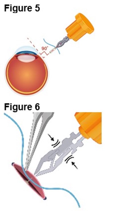 Figures 5 And 6 (Encelto Figure 3)