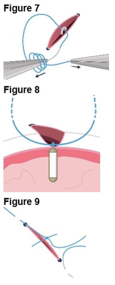 Figures 7-9 (Encelto Figure 4)
