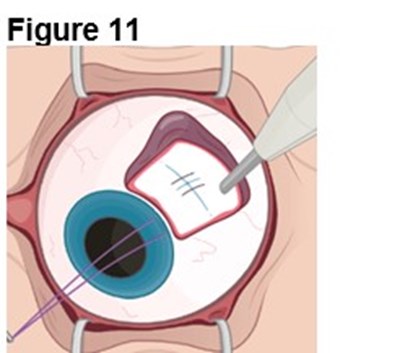 Figure 11 (Encelto Figure 6)