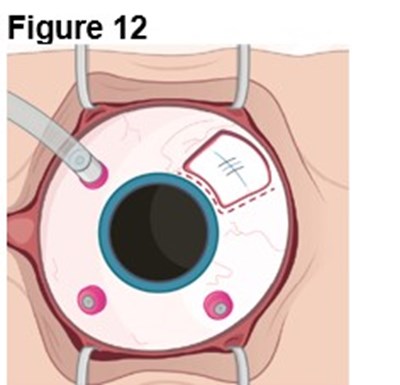 Figure 12 (Encelto Figure 7)