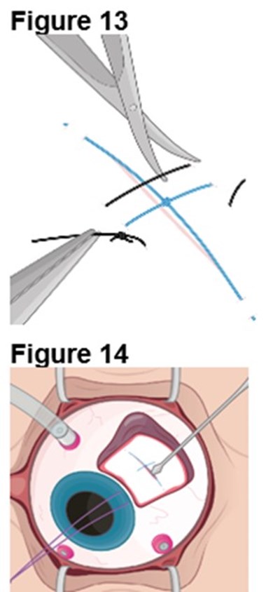 Figures 13 And 14 (Encelto Figure 8)
