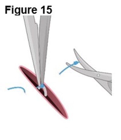Figure 15 (Encelto Figure 9)