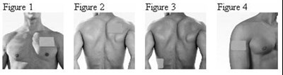 Instruction Figures 1, 2, 3, And 4 (893e63e0 F8c7 4899 88b0 A8d41ffcfe22 05)