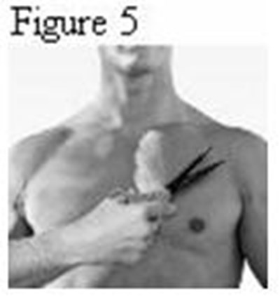 Instruction Figure 4 (893e63e0 F8c7 4899 88b0 A8d41ffcfe22 06)
