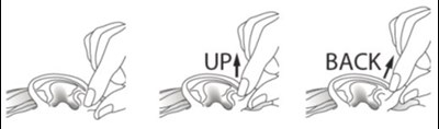 Up Back (Figuree)