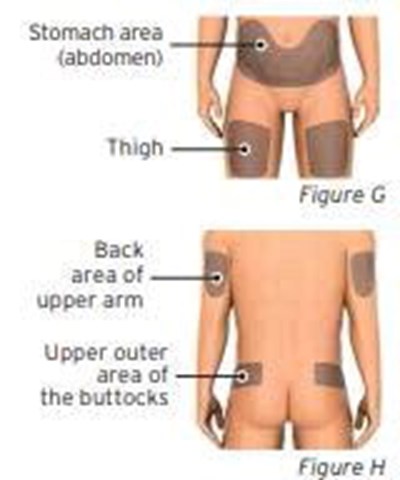Figures G And H (Sti0a 0000 07)