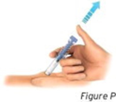 Figure P (Sti0a 0000 14)