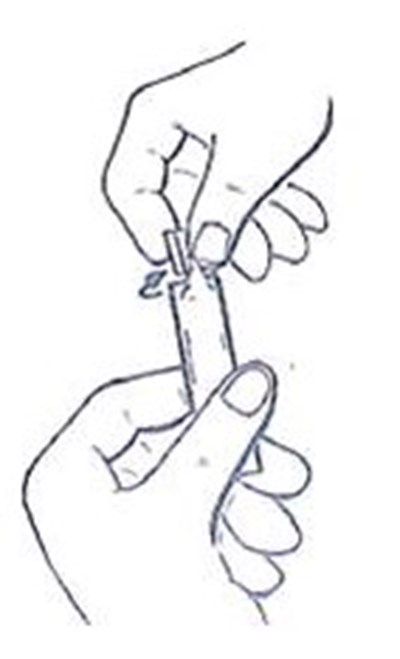 Image Description (Ipatropium Bromide Fig 1)