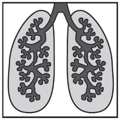 Figure 5 (Cromolyn05)