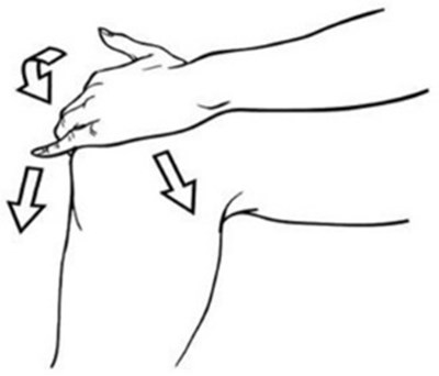 Figure B (Diclofenac 03)