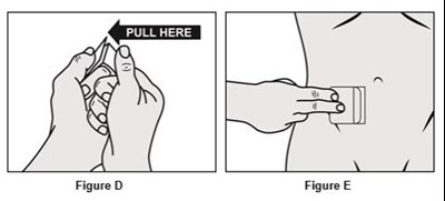 oxytrol-08.jpg · The sticky adhesive side of the patch is covered by 2 strips of overlapping protective liner. See Figure D.· Remove the first piece of the protective liner and place the patch, adhesive face down, firmly onto the skin. See Figure E. - oxytrol 08