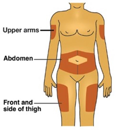 Site Of Injection On Body (Image 01)