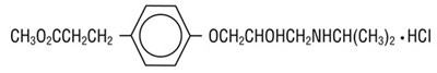 Esmolol Hydrochloride Structural Formula (Image 02)