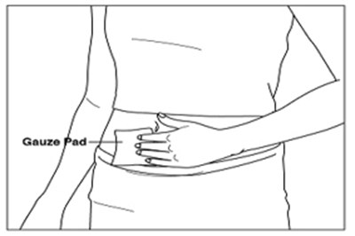 Figure Aa (Menopur 28)