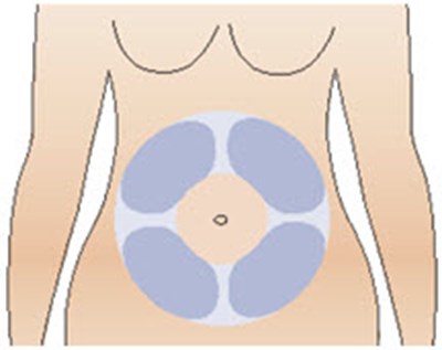 Figure S (Cablivi 21)
