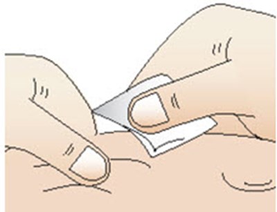 Figure T (Cablivi 22)