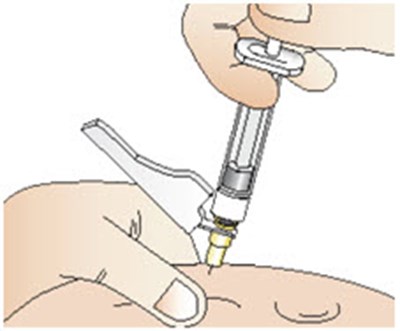 Figure Y (Cablivi 27)