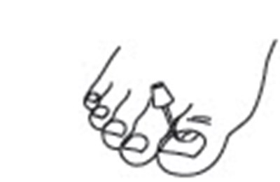 Figure 2 (Ciclodan 03)
