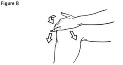 Figure B - diclofenac 03