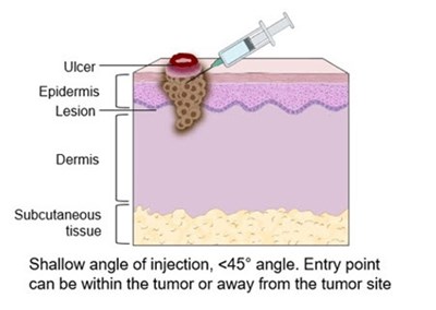 Figure 2a (Tudriqev 03)