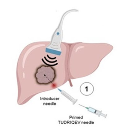 Figure 4a (Tudriqev 07)