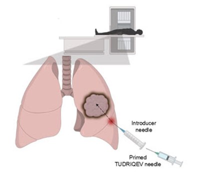 Figure 4b (Tudriqev 08)