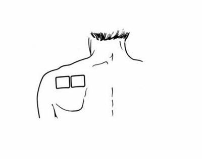 Figure B (Buprenorphine 07)