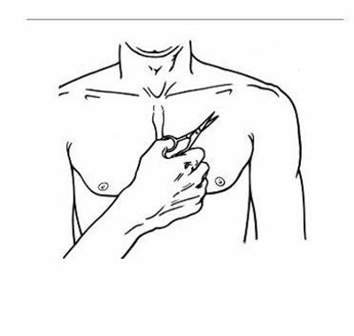 Figure C (Buprenorphine 08)