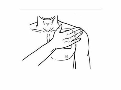 Figure I (Buprenorphine 14)