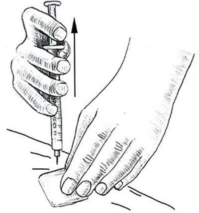 Figure K (Leuprolide Acetate Injection 12)