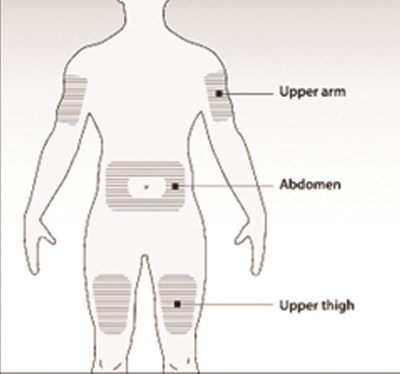 Step 2a (Boncresa Denosumab Mobz Injection 3)