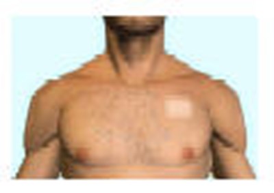 Figure 1 (Fts 04)