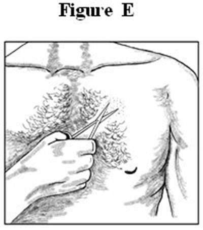 Medication Guide Figures E - image 03