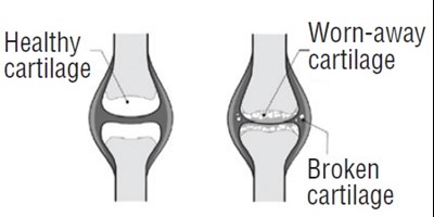 figure - diclofenac fig13