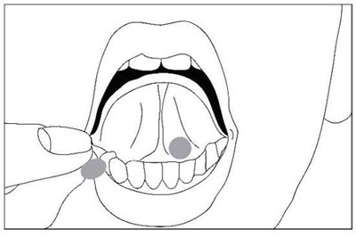buprenorphine and naloxone sublingual tablets 3