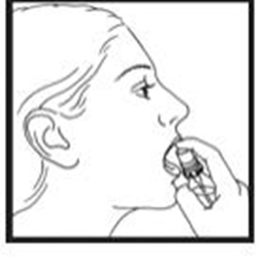 nitrolingual-pumpspray-04.jpg Press down on the top of the grooved button firmly with your index finger to release the spray onto or under your tongue. (See Figure D). The grooved button can help you make sure the canister is turned to the correct position if you are administering the spray in the dark. - nitrolingual pumpspray 04