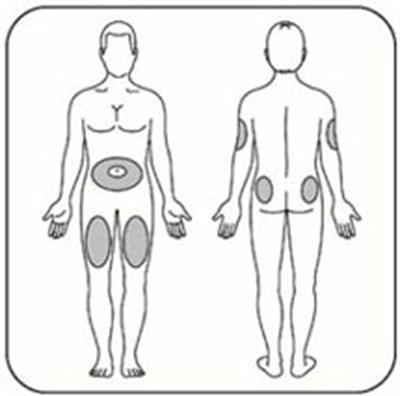 Figure (Lispro Inj Sites V1)