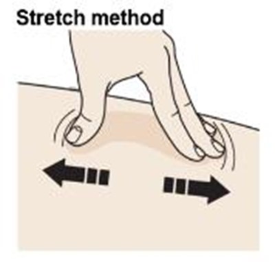 Stretch Method (Enbrel 0a)