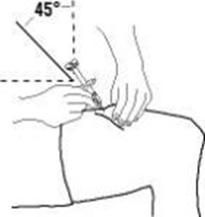 2.	With One Hand, Gently Pinch The Cleaned Area Of Skin And Hold It Firmly.  With The Other Hand, Hold The Syringe (like A Pencil) At A 45 Degree Angle To The Skin. (Enbrel 3e)