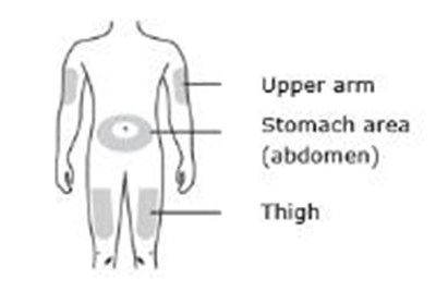 Prepare And Clean Your Injection Site. (Enbrel 57)