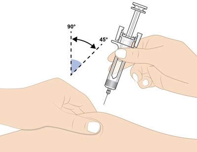 Figure K (Image 11)