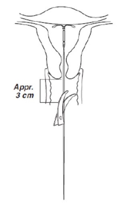 Cutting Threads (Image 09)