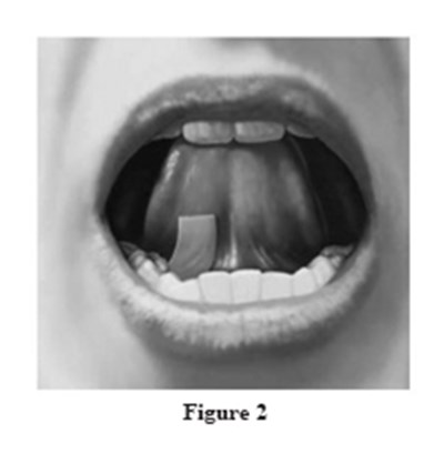 Figure-2 (Figure 2)