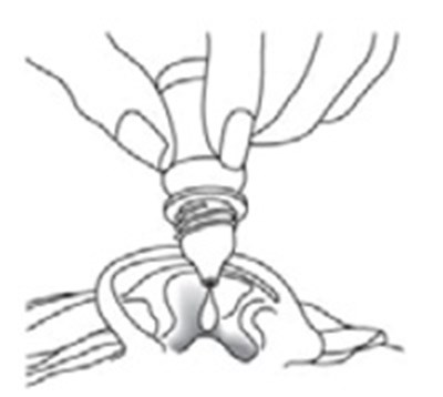 Figure D (Spl Figure C)