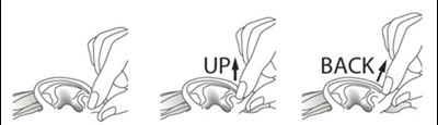 Figure E (Spl Figure E)