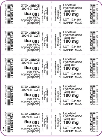 NDC Package 60687-439-01 Labetalol Hydrochloride Tablet, Film Coated Oral