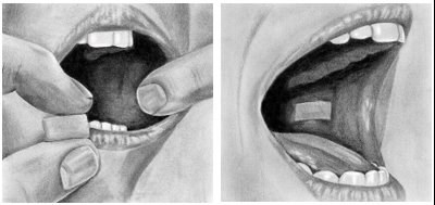 Instructions For Use Figure 3 (Image 09)
